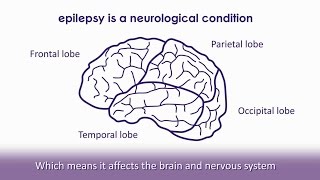 What is epilepsy  Epilepsy Society [upl. by Orola374]