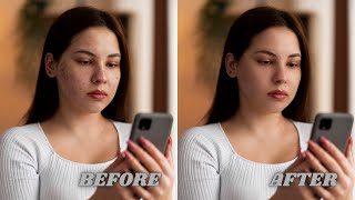 Face Retouching  Best Photoshop Tutorial  Skin Retouching [upl. by Haimaj19]