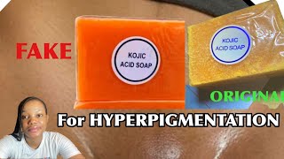 The Kojic Acid Soap That Works HOW TO IDENTIFY THE ORIGINAL [upl. by Zuleika]