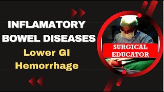 INFLAMMATORY BOWEL DISEASE  How To DIAGNOSE amp TREAT Lower GI Hemorrhage [upl. by Elinnet]