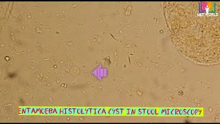 Entamoeba histolytica cyst in stool microscopy [upl. by Aerua]