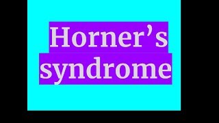 Hornerâ€™s syndrome [upl. by Frasquito]