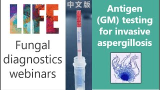 Aspergillus antigen galactomannan  fungal diagnostics webinar with QampA invasive aspergillosis [upl. by Edak526]