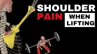 Preventing Shoulder Pain While Lifting [upl. by Fernas]