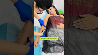 Day in my life😱 crafteraditi shorts youtubeshorts makeO laserhairremoval CrafterAditi [upl. by Nolrak]