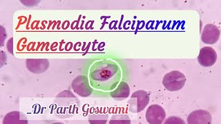 Plasmodia Falciparum Gametocyte  Morphology in Peripheral blood smear [upl. by Walrath140]