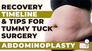 Tummy Tuck – Recovery Time and Recovery tips  Abdominoplasty Surgery in Delhi  Dr PK Talwar [upl. by Bullock]