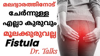 മലദ്വാരത്തിനോട് ചേർന്നുള്ള എല്ലാ കുരുവും മൂലക്കുരുവല്ല ഡോക്ടർ വിശദീകരിക്കുന്നു FISTULA [upl. by Ottavia976]