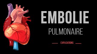 Embolie Pulmonaire  Cardiologie Urgence  Détails [upl. by Delphine662]