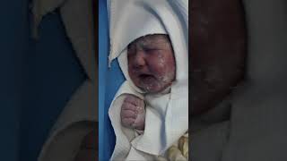 First cry of a newborn baby after delivery with vernix cutebaby [upl. by Kowtko]