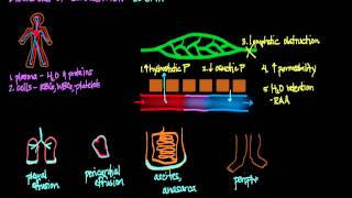 Disorders of Circulation Edema [upl. by Louanna]