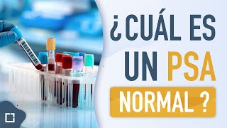 Próstata inflamada o grande ¿cual es un PSA NORMAL [upl. by Lahsram]