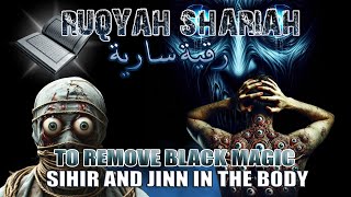 RUQYAH SHARIAH TO REMOVE BLACK MAGIC SIHIR AND JINN IN THE BODY AND NESTING IN THE HOUSE [upl. by Rehpotsrhc]