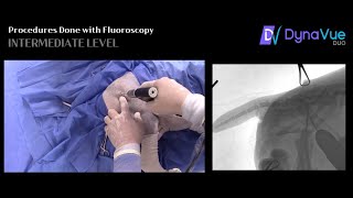 Minimally Invasive Intervention The IntermediateLevel of Fluoroscopy in Veterinary Healthcare [upl. by Teena524]