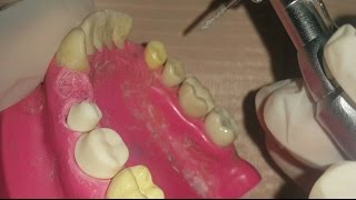 Dental Options with Prosthodontist Dr David McFadden [upl. by Lynden]