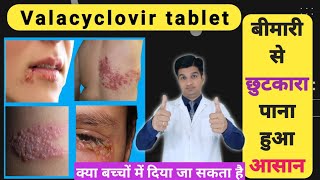 नहीं सहनी पड़ेगी यह दर्दनाक बीमारी  Valcivir 1000 mg tablet uses in hindi [upl. by Sousa]