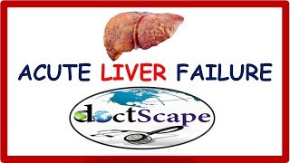 ACUTE LIVER FAILURE by DoctScape [upl. by Phox]