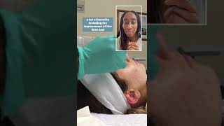 MICRONEEDLING FOR ACNE SCARRING Everyone meet my wonderful patient [upl. by Benito]