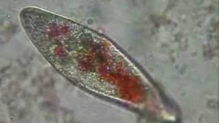 Paramecium eating pigmented yeast [upl. by Nigen]