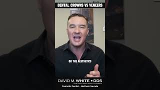 Dental Crowns vs Veneers [upl. by Atil]