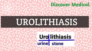 Urolithiasis  Reason Symptoms Diagnosis  Kidney stones [upl. by Dorcia852]