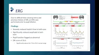 RETeval Case Study DR Score Prompts Critical Referral Jeff Calhoun OD FAAO [upl. by Vieva]