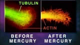 NeuroToxin  Mercury Melts Your Brain [upl. by Rosenberger609]