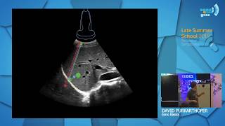 Sono Basics  Grundlagen der fokussierten Sonographie  David Purkarthofer  Late Summer School 2019 [upl. by Hardej]