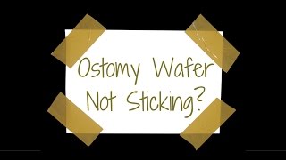 Ostomy wafer not sticking Here are a few tips [upl. by Poock]