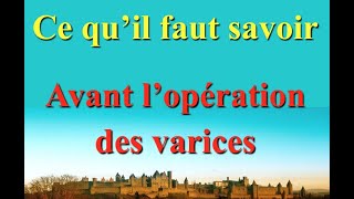 Chirurgie des varices  ce qu’il faut savoir avant l’opération [upl. by Fortunia]