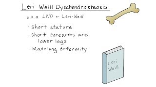 LeriWeill dyschondrosteosis [upl. by Wolf]