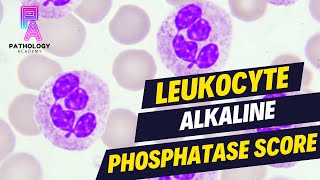 LAP SCORE Leukocyte Alkaline Phosphatase Score  By Dr Aditi Kumar [upl. by Levey]