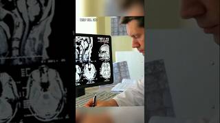 How X ray works shorts xray facts [upl. by Ytnom]