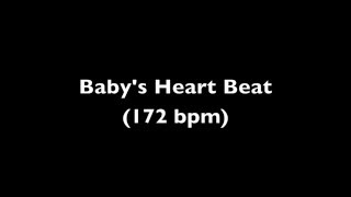 Fetal Heart Beat Audio 11 Weeks Pregnant [upl. by Nuhsed]