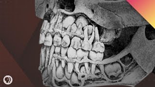 Where Do Teeth Come From [upl. by Lonyer]