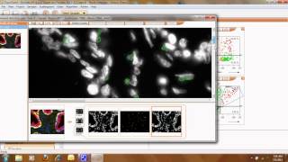 TissueQuest Cell amp Tissue Analysis Software [upl. by Cheney]