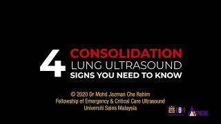 4 Consolidation Lung Ultrasound Signs You Need To Know [upl. by Anneiv]