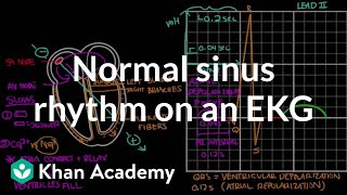 Normal sinus rhythm on an EKG  Circulatory System and Disease  NCLEXRN  Khan Academy [upl. by Nesnej]