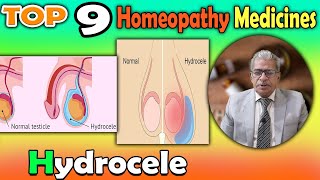 Hydrocele Causes Symptoms and homeopathy Treatment  Dr P S Tiwari [upl. by Haleigh681]