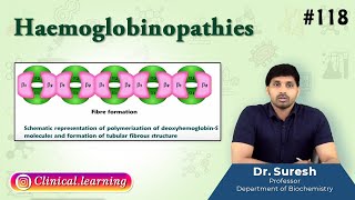 118 Haemoglobinopathies  Medical Biochemistry  USMLE FMGE and NEET PG [upl. by Tisbee]