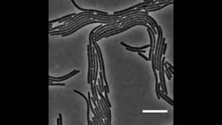 Bacteria motility8  Swarming  Proteus mirabilis [upl. by Alyssa]