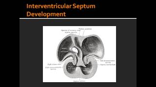 Interventricular Septum Development [upl. by Luke841]