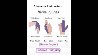 nerve injuries nueronline medicose medicine Sudarshanlipane177 💉💊🩺🏥⛑️⛑️⛑️⛑️⛑️ [upl. by Auoz]