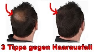 3 Tipps gegen Haarausfall [upl. by Owades615]