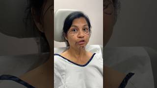 How Old is She 😳 Plastic Surgery Transformation facelift [upl. by Sivra12]