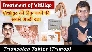 Trioxsalen tablets usp 25 mg  Vitiligo  Leucoderma Treatment In Hindi  सफ़ेद दाग़ कारण इलाज [upl. by Ibrab]