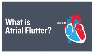 What is atrial flutter [upl. by Eniamurt894]