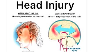 Head Injury Cause Symptom Diagnose Treatment What Is Head Injury What is Brain injuryHead Injury [upl. by Ellekcim]