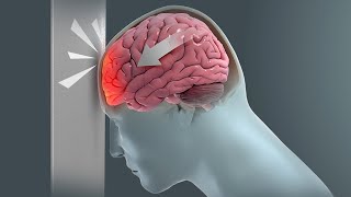 How Traumatic Brain Injury TBI Affects Brain Cells  New Research Could Lead to New Treatments [upl. by Midis]