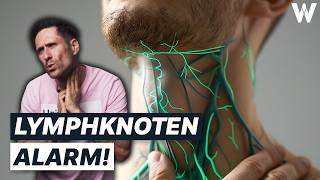 Unbekannte Knubbel Gefährlich von harmlos unterscheiden Wichtigsten Fakten zu großen Lymphknoten [upl. by Enid]